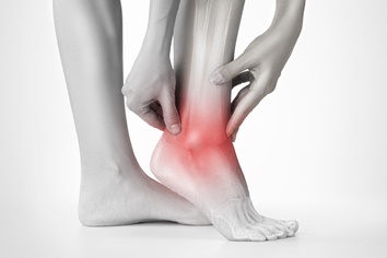Arthritis in an Ankle | Experienced Idaho Podiatrist