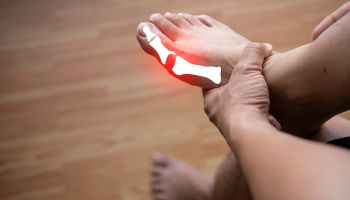 Arthritis in feet | Experienced Idaho Podiatrist