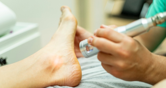 Caldwell-Meridian-podiatrist-using-MLS-laser-for-plantar-fasciitis