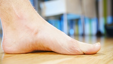 Foot With a High Arch | Experienced Idaho Podiatrist