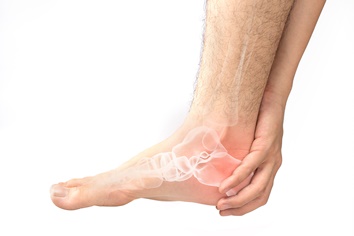 Calcaneal Fracture in a Heel | Experienced Idaho Podiatrist