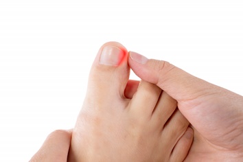 Ingrown Big Toenail | Experienced Idaho Podiatrist