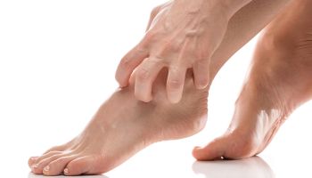 Itchy feet | Experienced Idaho Podiatrist