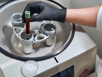Tube going into centrifuge for PRP therapy | Experienced Idaho Podiatrist