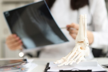Doctor Looking at Turf Toe X-Rays | Experienced Idaho Podiatrist