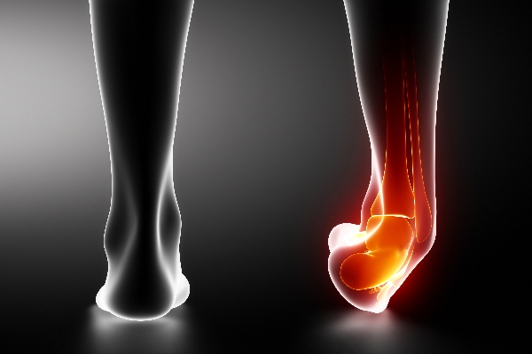 Ankle Instability X-Ray | Experienced Idaho Podiatrist