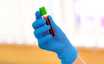 gloved hand holding blood vial prp therapy