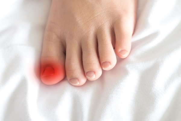 childs-foot-ingrown-toenail | Experienced Idaho Podiatrist
