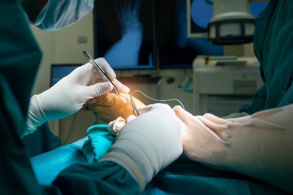 Podiatrist performing bunion surgery | Idaho Bunion Podiatrist