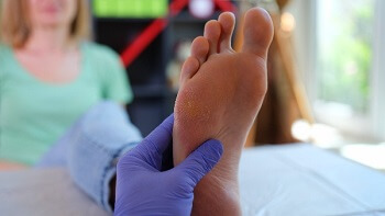 Podiatrist administering cortisone injection into a patient&rsquo;s heel to relieve plantar fasciitis pain
