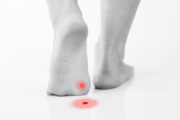 person with plantar wart shown in red walking away | Experienced Idaho Podiatrist