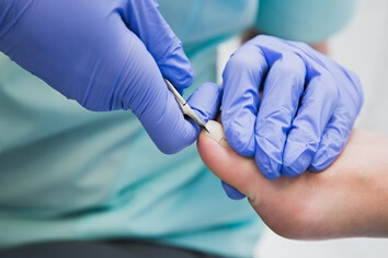podiatrist treating ingrown toenail | Experienced Idaho Podiatrist