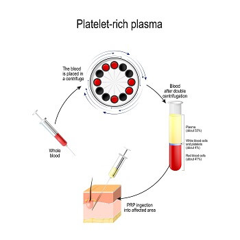 prp therapy for foot issues idaho Podiatrists